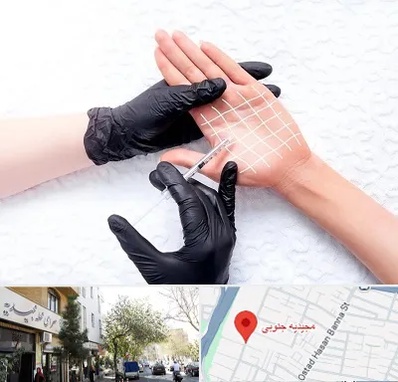تزریق بوتاکس کف دست در مجیدیه جنوبی