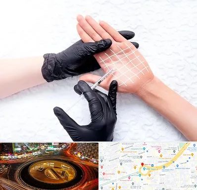 تزریق بوتاکس کف دست در میدان ولیعصر 