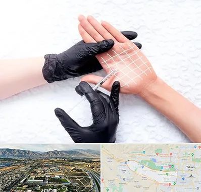 تزریق بوتاکس کف دست در منطقه 21 تهران 