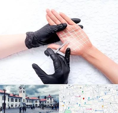 تزریق بوتاکس کف دست در میدان شهرداری رشت