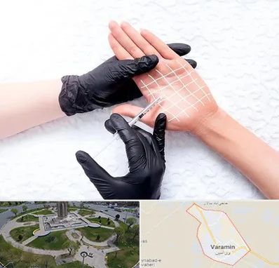 تزریق بوتاکس کف دست در ورامین