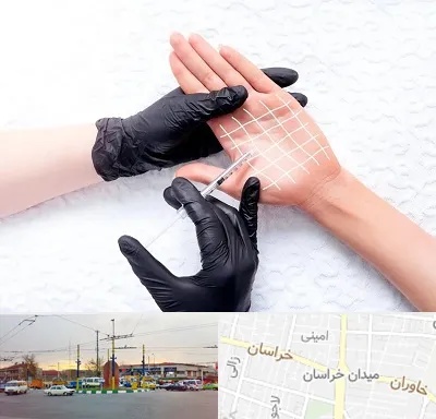 تزریق بوتاکس کف دست در میدان خراسان