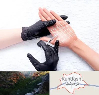 تزریق بوتاکس کف دست در کوهدشت