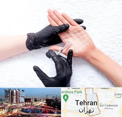 تزریق بوتاکس کف دست در صادقیه 