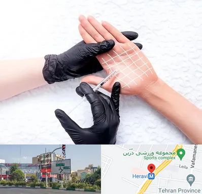 تزریق بوتاکس کف دست در هروی 