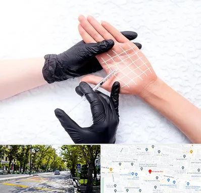 تزریق بوتاکس کف دست در میرداماد 