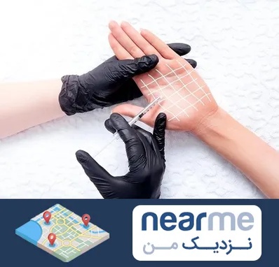 تزریق بوتاکس کف دست در نزدیک من