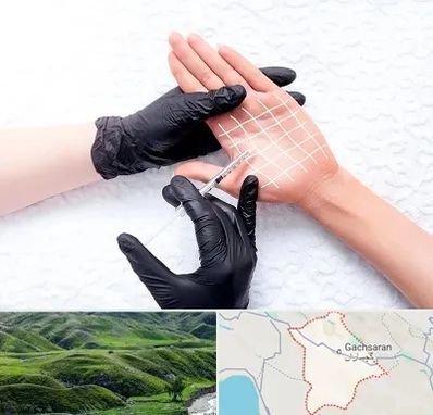 تزریق بوتاکس کف دست در گچساران