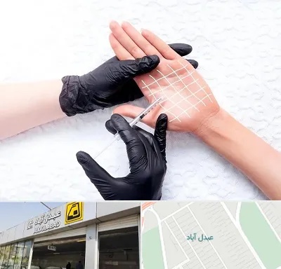 تزریق بوتاکس کف دست در عبدل آباد