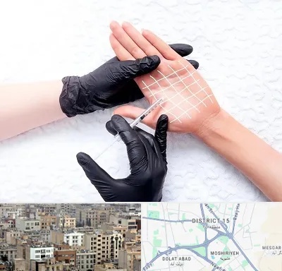 تزریق بوتاکس کف دست در جنوب شرق تهران