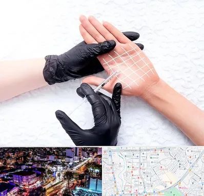 تزریق بوتاکس کف دست در منظریه رشت