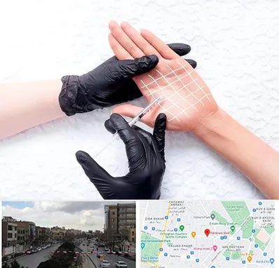تزریق بوتاکس کف دست در بلوار فردوسی مشهد