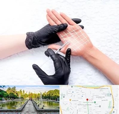 تزریق بوتاکس کف دست در سرسبز 