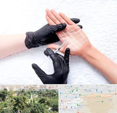 تزریق بوتاکس کف دست در منطقه 13 تهران 