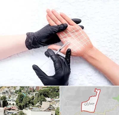 تزریق بوتاکس کف دست در جماران