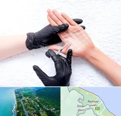 تزریق بوتاکس کف دست در رامسر