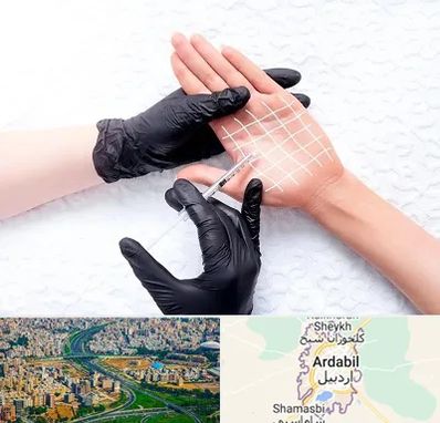 تزریق بوتاکس کف دست در اردبیل