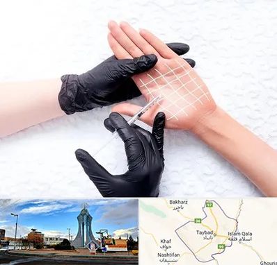 تزریق بوتاکس کف دست در تایباد