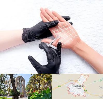 تزریق بوتاکس کف دست در نیشابور