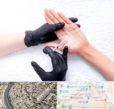 تزریق بوتاکس کف دست در شهرک غرب مشهد