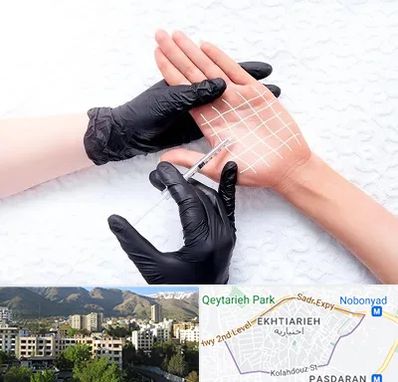 تزریق بوتاکس کف دست در اختیاریه 
