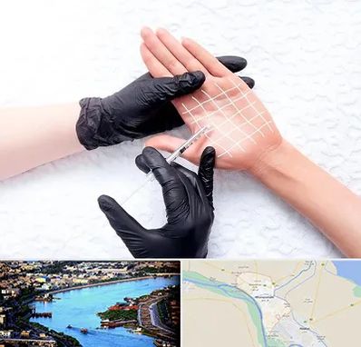تزریق بوتاکس کف دست در خرمشهر