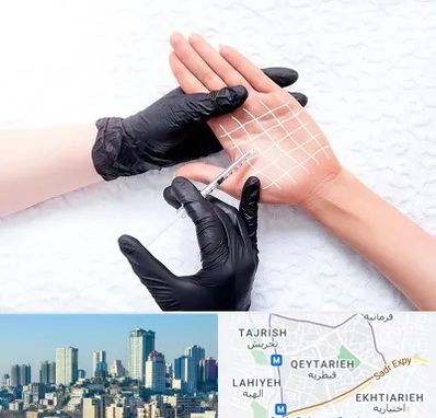 تزریق بوتاکس کف دست در قیطریه 