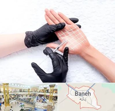 تزریق بوتاکس کف دست در بانه