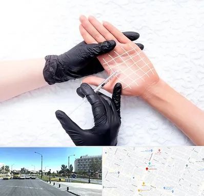 تزریق بوتاکس کف دست در بلوار کلاهدوز مشهد