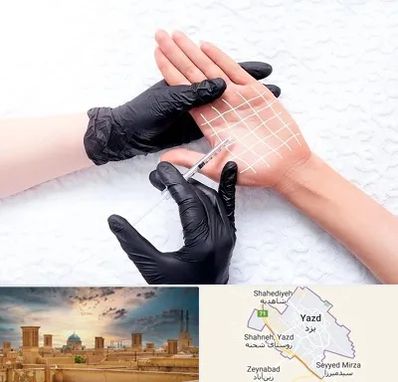 تزریق بوتاکس کف دست در یزد