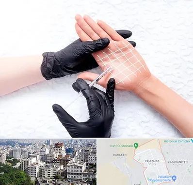 تزریق بوتاکس کف دست در ولنجک 