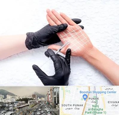 تزریق بوتاکس کف دست در پونک 