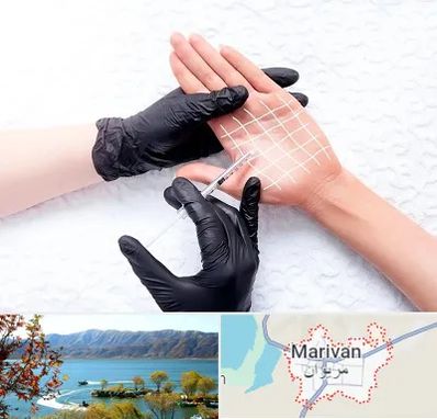 تزریق بوتاکس کف دست در مریوان
