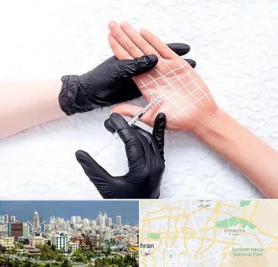 تزریق بوتاکس کف دست در شرق تهران 