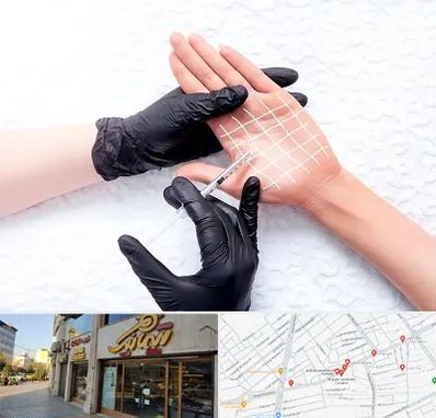 تزریق بوتاکس کف دست در عطاران قم