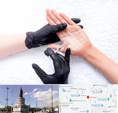 تزریق بوتاکس کف دست در کارگر جنوبی 