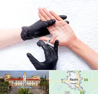 تزریق بوتاکس کف دست در رشت