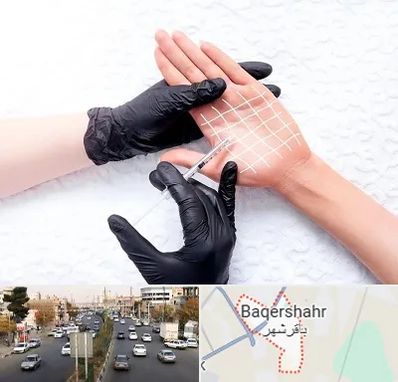 تزریق بوتاکس کف دست در باقرشهر