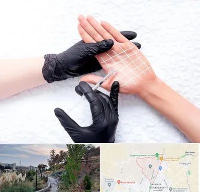 تزریق بوتاکس کف دست در باغستان کرج