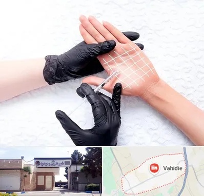 تزریق بوتاکس کف دست در وحیدیه شهریار