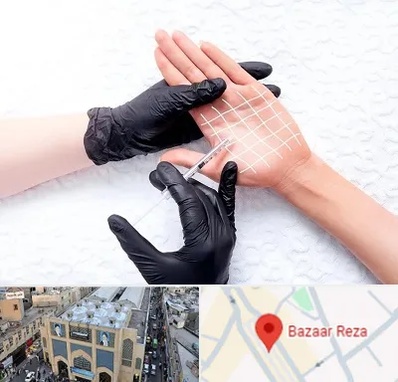 تزریق بوتاکس کف دست در بازار رضا مشهد