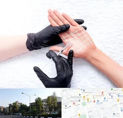 تزریق بوتاکس کف دست در میدان کاج 