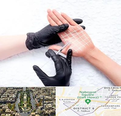 تزریق بوتاکس کف دست در نارمک 