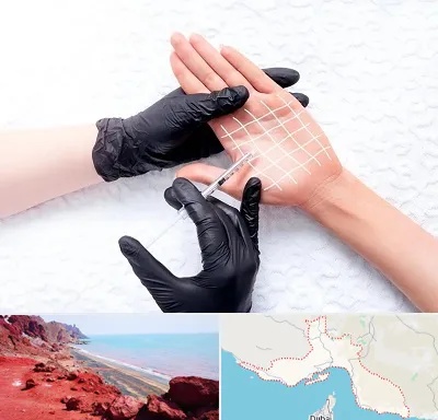 تزریق بوتاکس کف دست در هرمزگان
