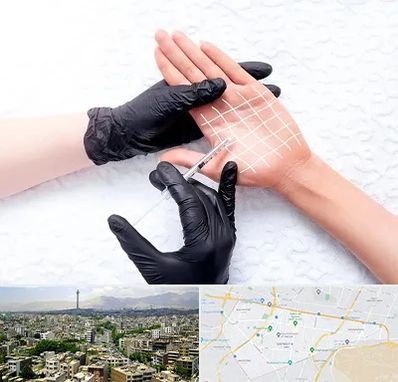 تزریق بوتاکس کف دست در منطقه 8 تهران 