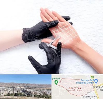 تزریق بوتاکس کف دست در شهرک گلستان شیراز
