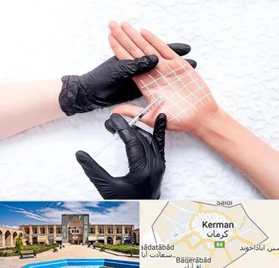 تزریق بوتاکس کف دست در کرمان