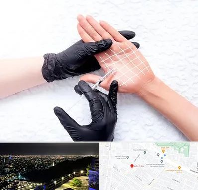 تزریق بوتاکس کف دست در هفت تیر مشهد