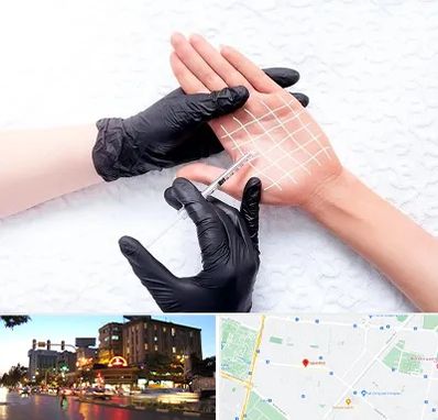 تزریق بوتاکس کف دست در بلوار سجاد مشهد