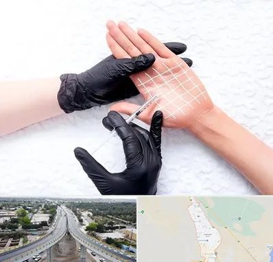 تزریق بوتاکس کف دست در اندیمشک